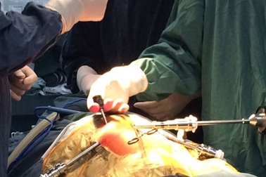 Bệnh viện Nhi TW thực hiện thành công 54 ca phẫu thuật nội soi robot