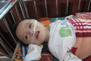 Bé gái bệnh tật bị bỏ rơi tại bệnh viện