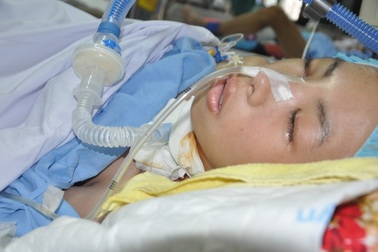 Bị tai nạn giao thông trên đường đi học, hai anh em sinh đôi nguy kịch tính mạng