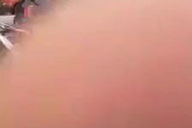 Du khách người nước ngoài và bạn gái bị hai thanh niên Việt Nam đánh sau va chạm giao thông