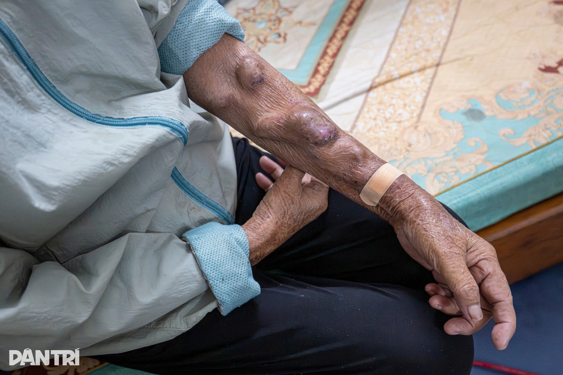 ជីវិតប្រជាជនតស៊ូជាមួយនឹងភាពត្រជាក់នីមួយៗក្នុងតំបន់លាងឈាមក្នុងទីក្រុងហាណូយ - ១២ Những phận người chật vật theo từng đợt rét tại xóm chạy thận Hà Nội - 12