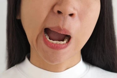 Liệt mặt sau một đêm, người phụ nữ suýt mang di chứng vì chữa mẹo