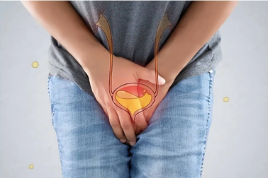 Tiên lượng điều trị ung bàng quang di căn như thế nào?