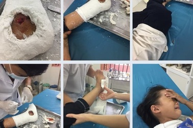 Cổng sắt trường Tiểu học sập, một nữ sinh lớp 3 bị thương