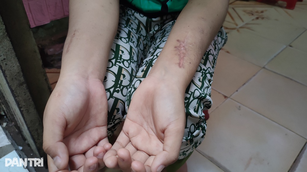 Cô bé số khổ, mẹ bỏ rơi từ nhỏ, một mình chống chọi với bệnh tật - 4 Cô bé số khổ, mẹ bỏ rơi từ nhỏ, một mình chống chọi với bệnh tật - 4