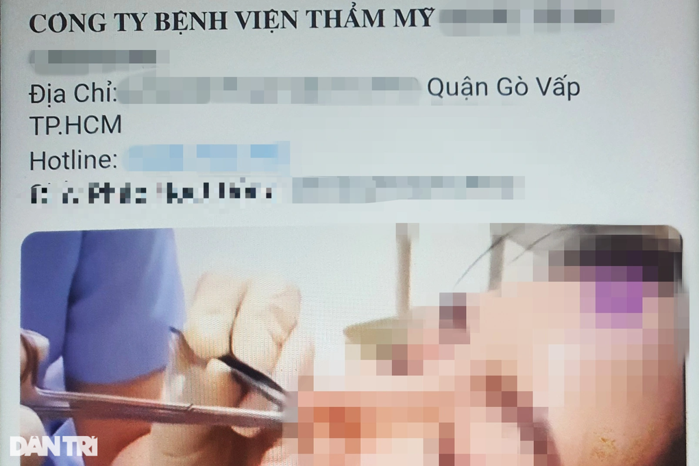 TPHCM: Đi thẩm mỹ quốc tế tiêm tan filler, bị biến chứng nặng - 2 TPHCM: Đi thẩm mỹ quốc tế tiêm tan filler, bị biến chứng nặng - 2