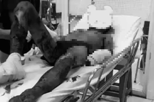 Hai học sinh thương vong ngày 29 Tết vì tự chế pháo