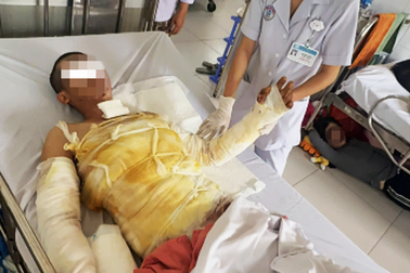 Sửa đèn bảng hiệu, người đàn ông 32 tuổi bị điện phóng gây bỏng nặng