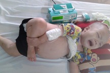 Xót xa bé 2 tuổi dân tộc Tày bụng to như cái trống vì hội chứng thận hư