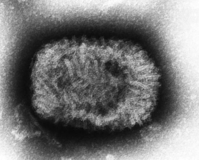 Những loại virus gây chết người kinh khủng nhất mọi thời đại - Ảnh 6.