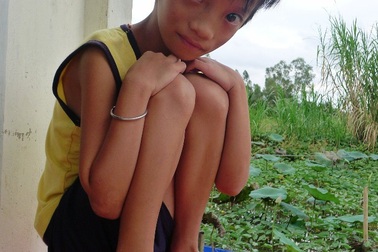 Mắc bệnh tim, bé 10 tuổi chỉ nặng... 12kg