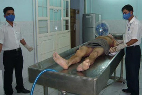 Nỗi ám ảnh của bác sĩ pháp y 