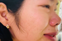 Giáo viên bị phụ huynh đánh bầm dập, hiệu trưởng nói "không liên quan"