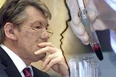 Yushchenko đồng ý xét nghiệm máu