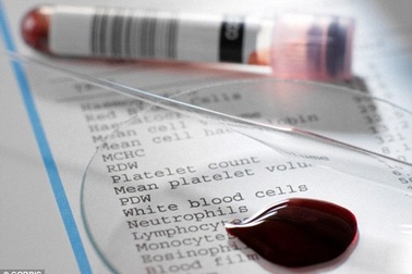 Vi rút HIV sống được bao lâu khi ở ngoài cơ thể?