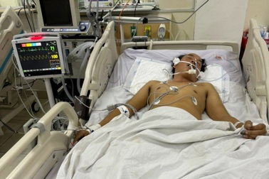 Hết rượu, lấy cồn rửa tay pha loãng để nhậu, 4 người đàn ông nhập viện