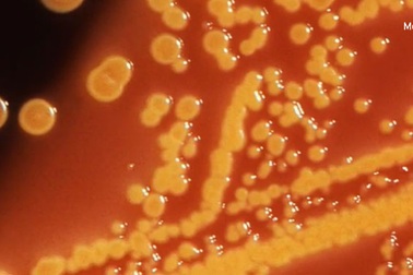 Báo động chủng nấm men kháng thuốc