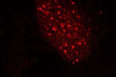 Xác định được thuốc dùng trong điều trị chứng tự kỷ