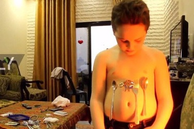 Cậu bé có khả năng hút kim loại như nam châm