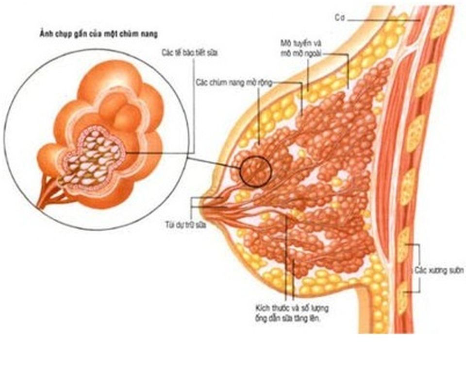 Cách thông tắc tia sữa với Home Care - 1 Cách thông tắc tia sữa với Home Care - 1