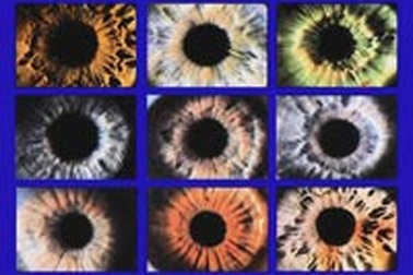 Intralase: Phương pháp ghép giác mạc mới