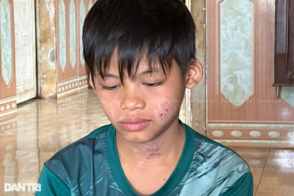 Giá như mẹ có thể chịu thay con những nỗi đau này! - 3 Giá như mẹ có thể chịu thay con những nỗi đau này! - 3