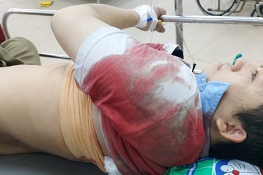 Tan ca đêm về, đôi vợ chồng bị nhóm "ninja" chặn xe đâm trọng thương