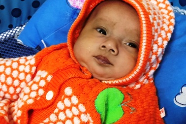 Thương bé sinh đôi chống chọi với bệnh tim bẩm sinh phức tạp