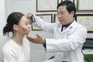 Uống thuốc tránh thai trị mụn, thiếu nữ mặt như "trận địa"