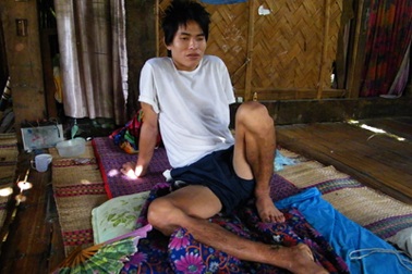 Lại chuyện đi rừng bị khỉ tấn công trọng thương