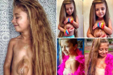 Bé 6 tuổi có trái tim ngoài lồng ngực