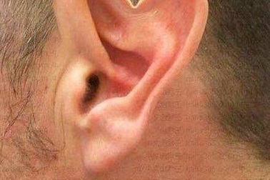 Cộng đồng mạng chia sẻ ảnh về các bộ phận cơ thể khác người của mình