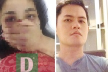 70 phút cực hình của nữ điều dưỡng bị bác sĩ đòi hiếp dâm, đánh đập