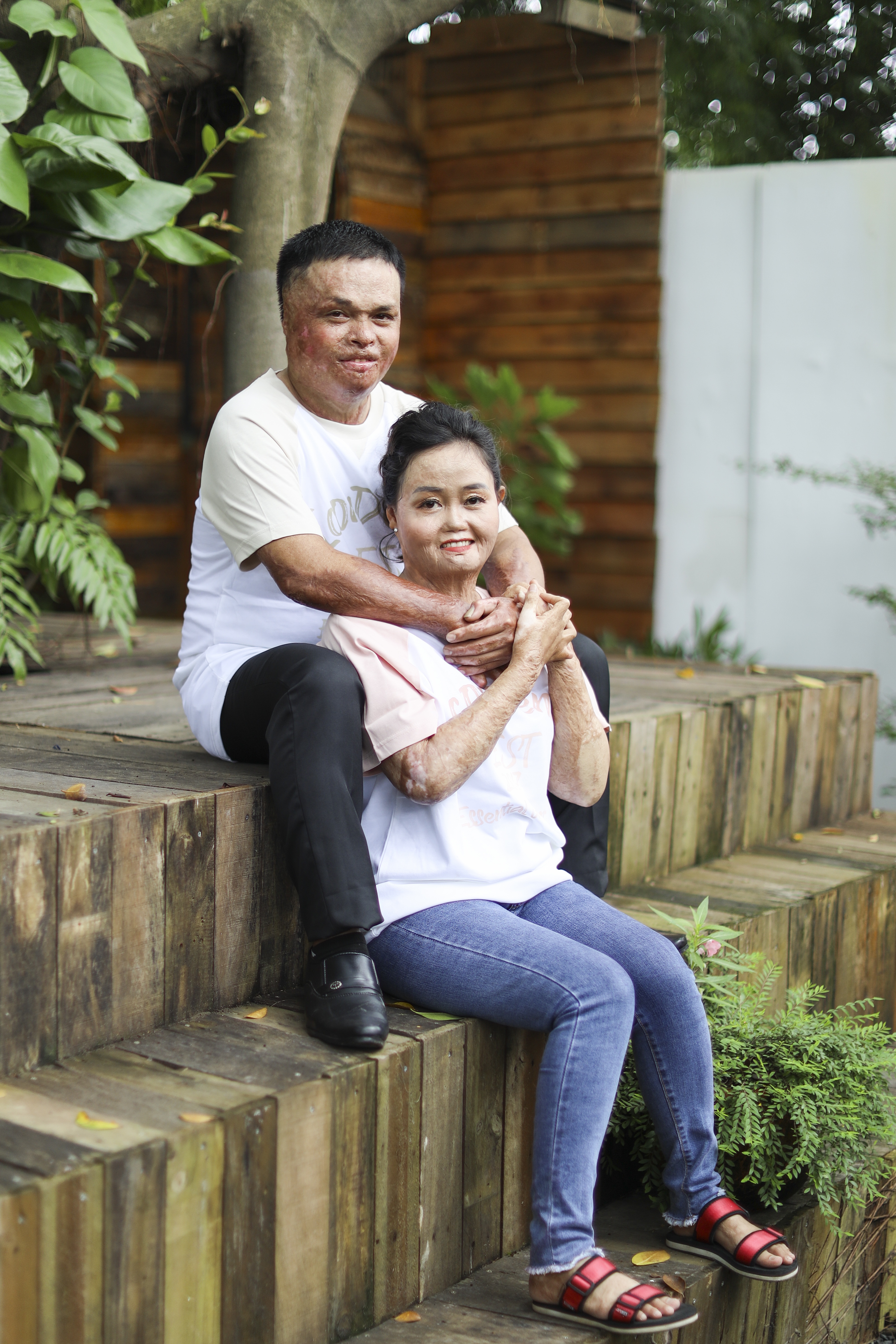 Tình yêu hồi sinh bà mẹ hai con từng bị chồng cũ thiêu sống - 1 Tình yêu hồi sinh bà mẹ hai con từng bị chồng cũ thiêu sống - 1