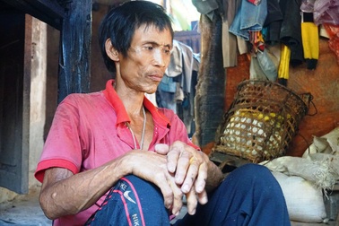 "Người rừng" Hồ Văn Lang suy kiệt vì bị ung thư giai đoạn cuối