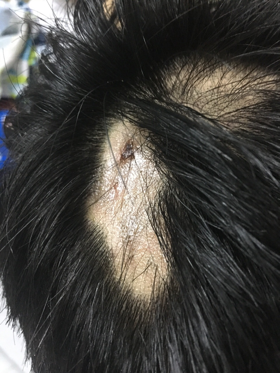 Nam sinh bị máy tiện quấn đứt cánh tay, gia đình bức xúc đòi hỗ trợ! - 9 Nam sinh bị máy tiện quấn đứt cánh tay, gia đình bức xúc đòi hỗ trợ! - 9