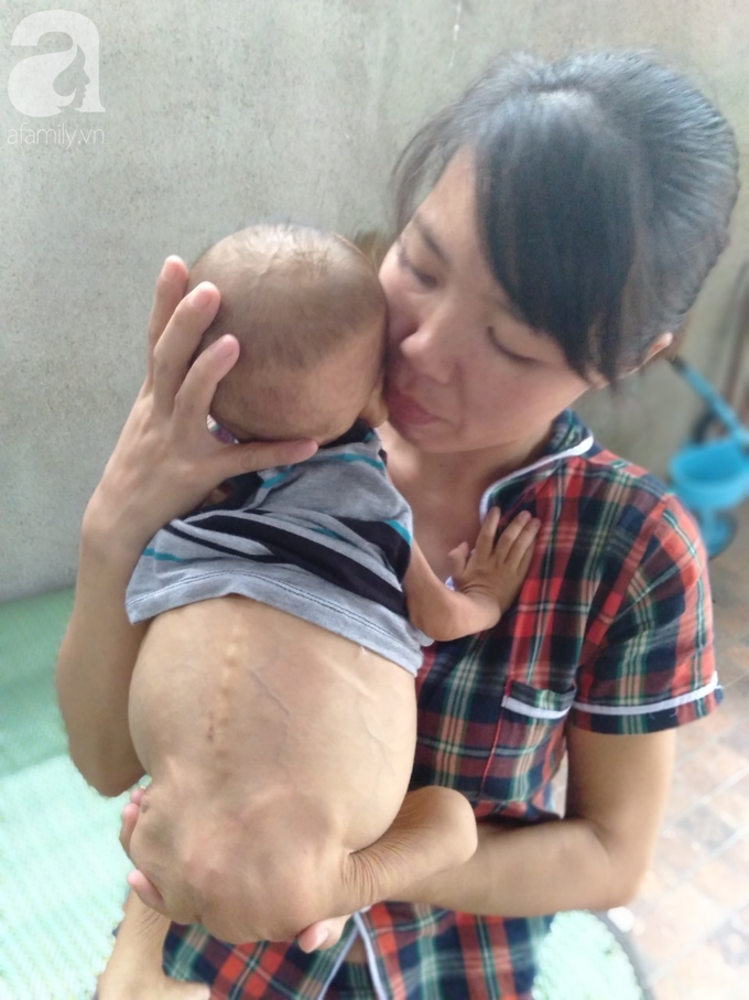 Sự sống mong manh của bé trai 1 tuổi, chỉ nặng 6kg, bụng phình to như cái trống mà mẹ nghèo không tiền chữa trị - Ảnh 5. Sự sống mong manh của bé trai 1 tuổi, chỉ nặng 6kg, bụng phình to như cái trống mà mẹ nghèo không tiền chữa trị - Ảnh 5.