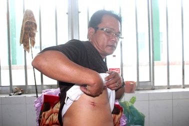 3 công an bị đâm khi khống chế kẻ dọa giết người