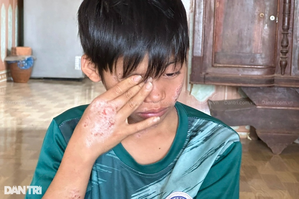 Giá như mẹ có thể chịu thay con những nỗi đau này! - 5 Giá như mẹ có thể chịu thay con những nỗi đau này! - 5