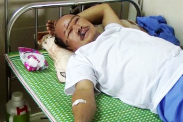 Công an xã bị nam thanh niên cầm đá đập vào đầu nhập viện