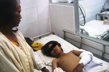 Nhờ thầy lang chữa rắn cắn, một bệnh nhi suýt mất mạng