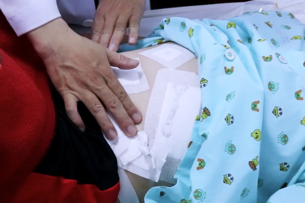 Cấp cứu 2 cháu bé lâm nguy vì mảnh kính vỡ, cây tăm xỉa răng - 3 Cấp cứu 2 cháu bé lâm nguy vì mảnh kính vỡ, cây tăm xỉa răng - 3