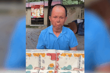 "Dị nhân mặt sẹo" từ chối tiền ủng hộ, miệt mài bán hàng online nuôi con