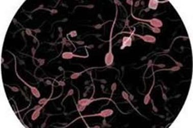 Tinh dịch “loãng” hay “đặc” thì tốt?