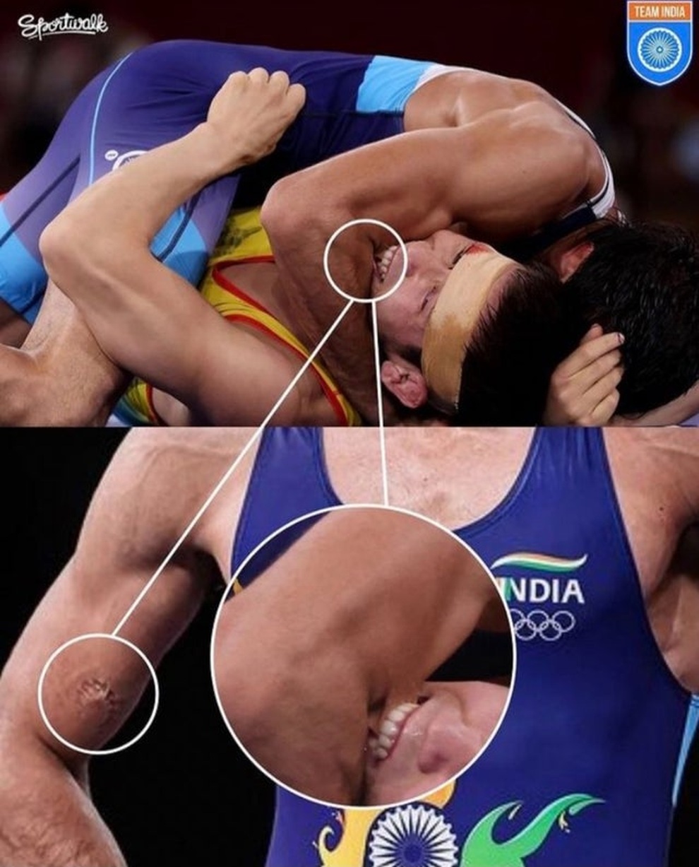 Đô vật cắn người ghê rợn, hằn dấu răng trên tay đối thủ - 2 Đô vật cắn người ghê rợn, hằn dấu răng trên tay đối thủ - 2