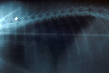 Nuốt thanh sắt dài nửa mét vào bụng