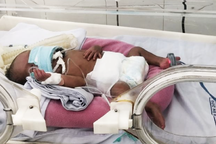 Cuộc chiến "sinh tử" của bé Messi chào đời khi thai mới 25 tuần tuổi