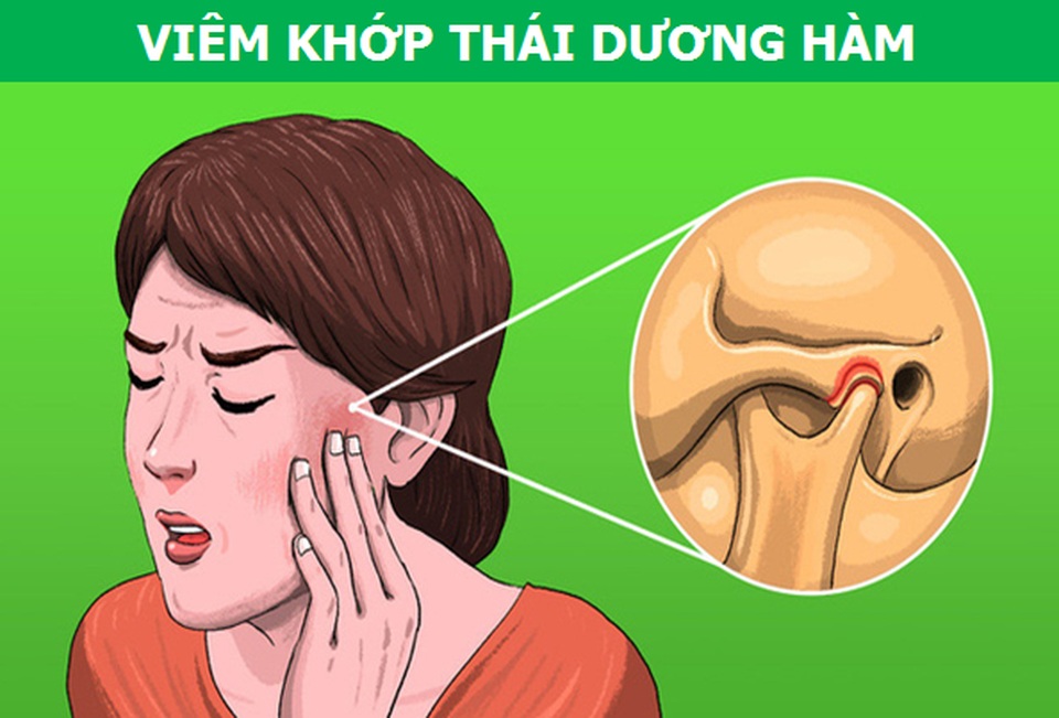 Những cơn đau kỳ lạ xuất phát từ răng miệng nói lên điều gì về sức khỏe? - 6 Những cơn đau kỳ lạ xuất phát từ răng miệng nói lên điều gì về sức khỏe? - 6