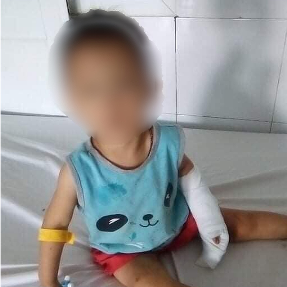 Níu kéo người yêu bất thành, gã đàn ông cắt đứt gân tay cháu bé 4 tuổi - 1 Níu kéo người yêu bất thành, gã đàn ông cắt đứt gân tay cháu bé 4 tuổi - 1