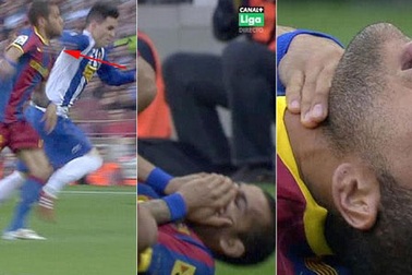 Dani Alves bị báo giới Madrid tố chơi bẩn